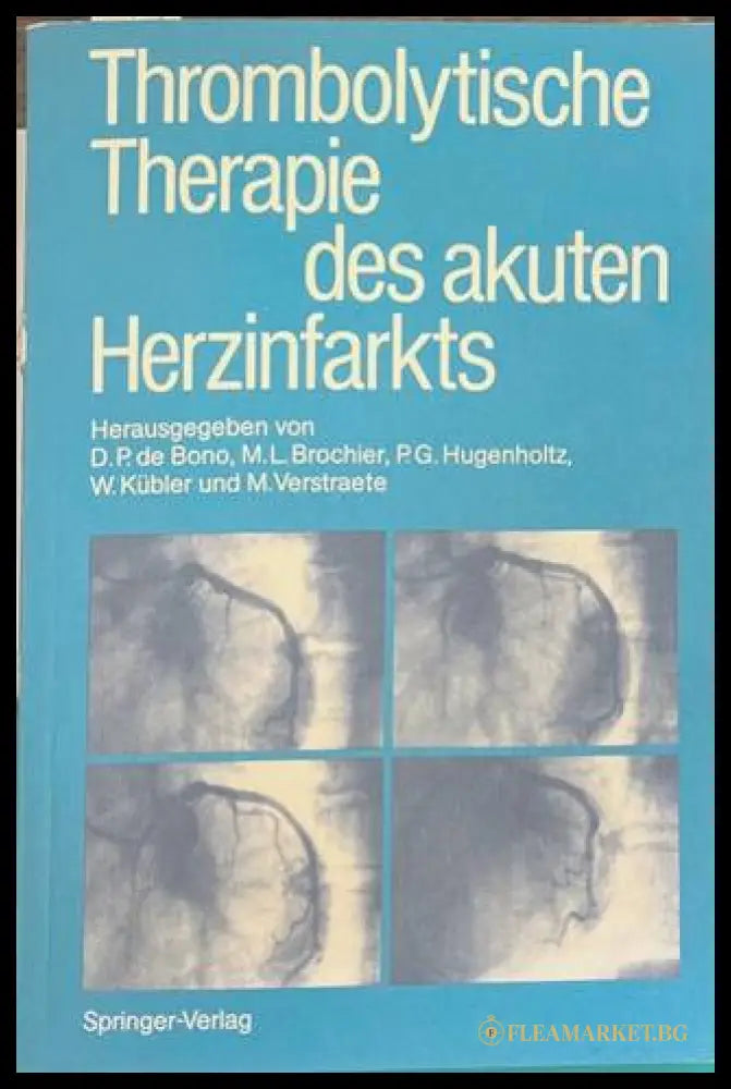 Thrombolytische Therapie des akuten Herzinfarkts - Springer-Verlag