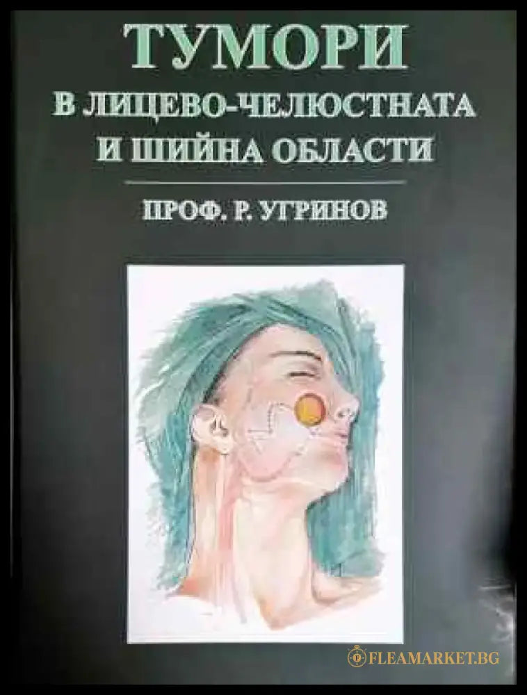 Тумори в лицево-челюстната и шийна области (1784) - Книга
