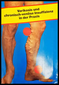 Varikosis und chronisch-venöse Insuffizienz in der Praxis - Hübner, Marshall