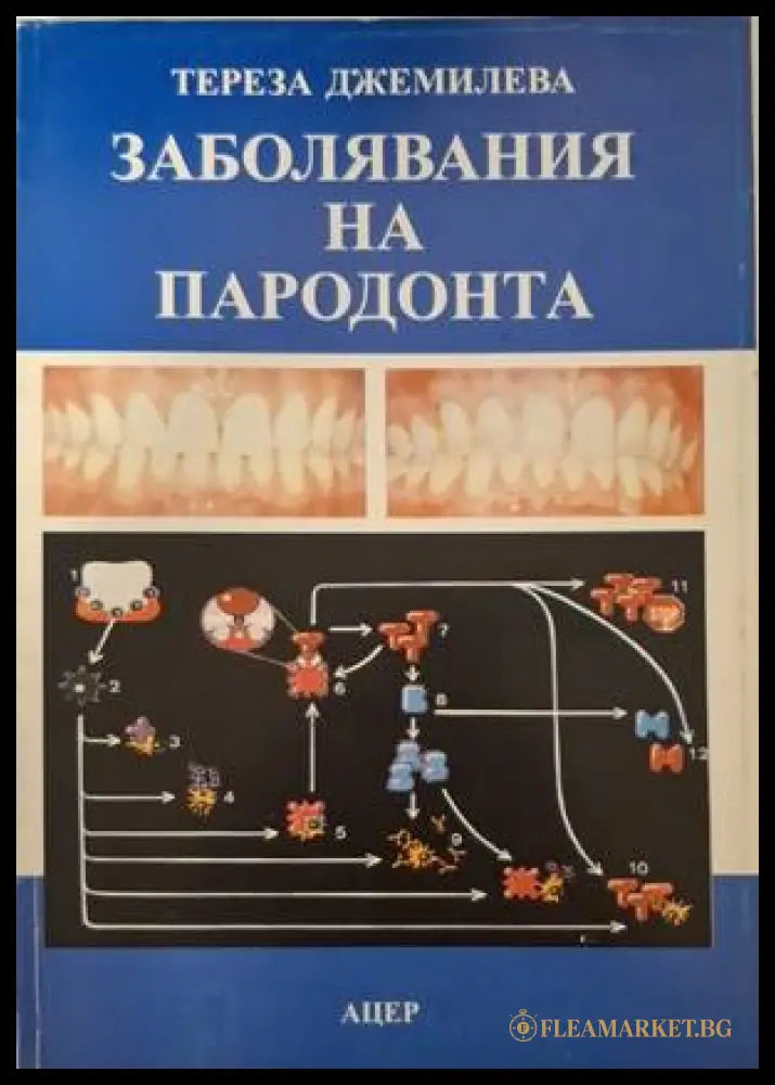 Заболявания на пародонта (182006261347) - Тереза Джемилева - Книга