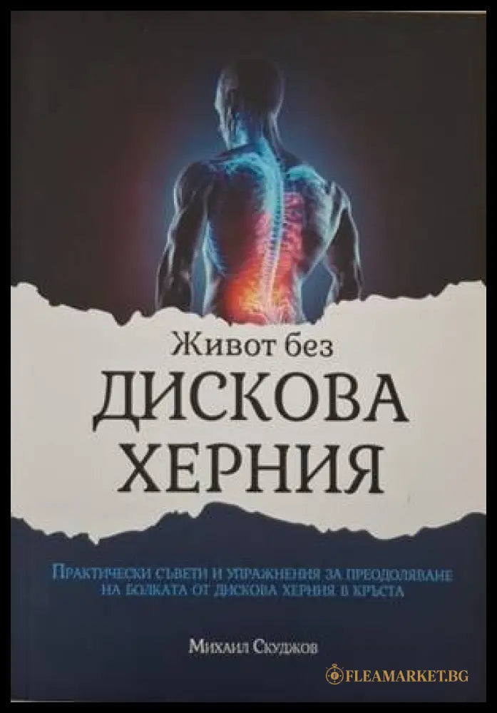 Живот без дискова херния (182006261405) - Михаил Скуджов - Книга