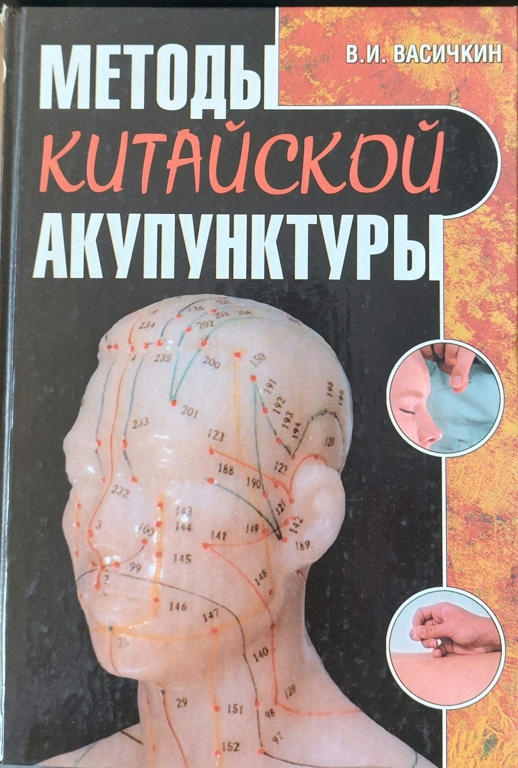 Китайскской акупунктуры