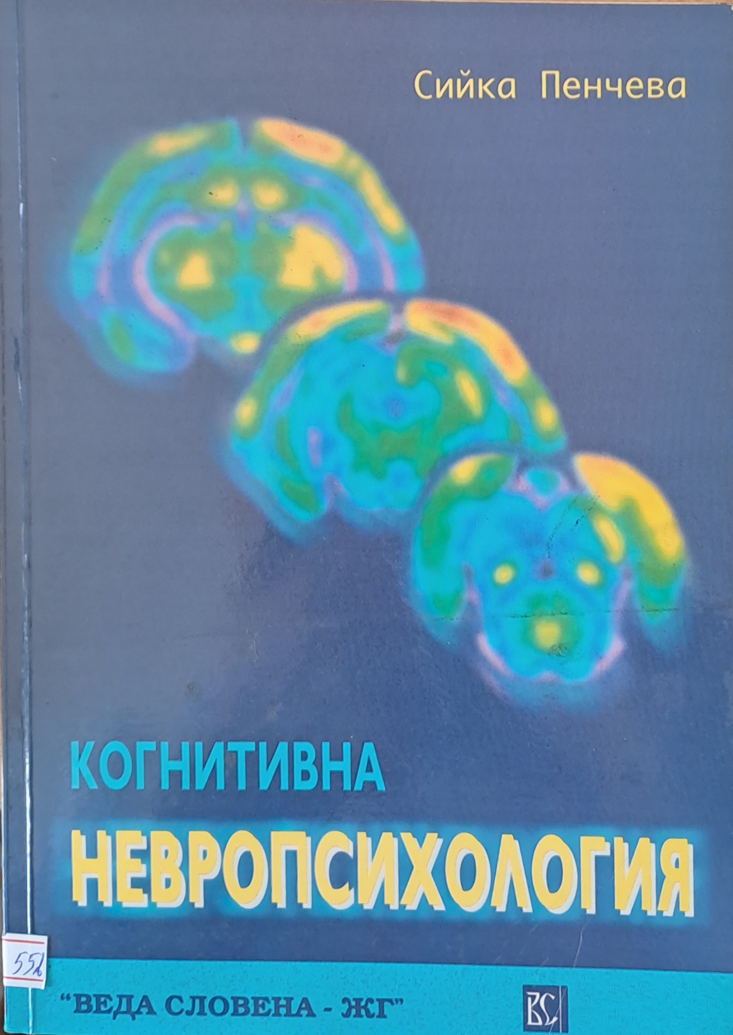 Когнитивна невропсихология - Fleamarket
