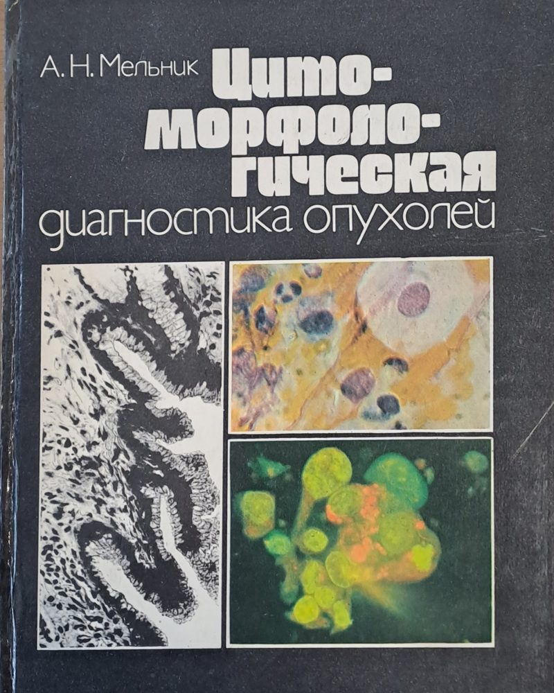 Цитоморфологическая диагностика опухолей